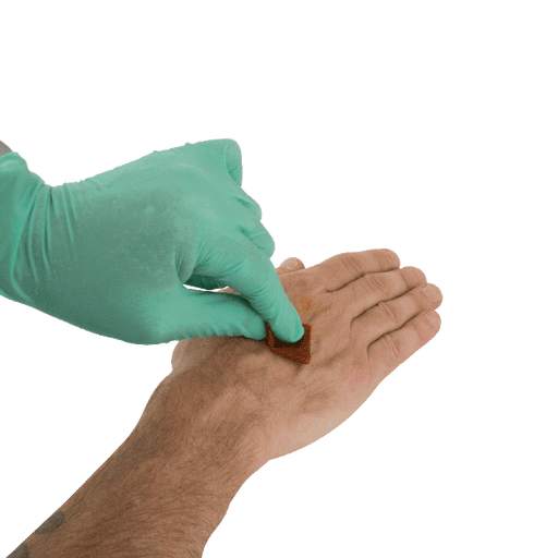 Povidone Iodine Prep Pad, Medium, 10/100/cs | Quantity - 1x CS