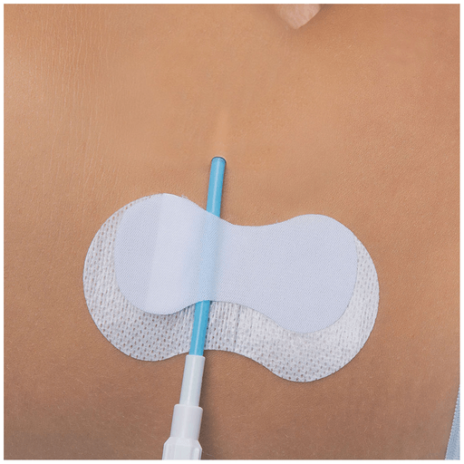 TIDI GRIP-LOK PICC/CVC SECUREMENT DEVICE - Securement Device, CVC, Sterile, Individually Packaged, 100/bx | Quantity - 1x BX