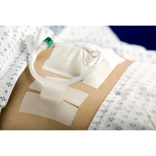 Cath-Secure™ Holder, Tube | Quantity - 1x EA