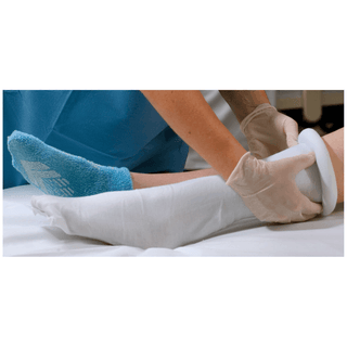 ALBA STERILE PRE-CUT STOCKINETTE - Double-Ply Stockinette, 4" x 36", 24/cs | Quantity - 1x CS