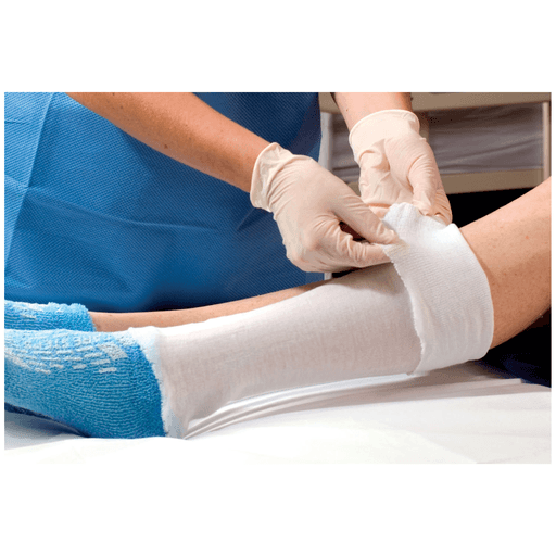 ALBA NON-STERILE STOCKINETTE - Stockinette, 10" x 25 yds, Tubular, Anti-Microbial Polyester, White, 4/cs | Quantity - 1x CS