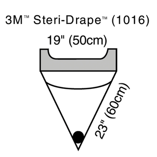 SOLVENTUM STERI-DRAPE IRRIGATION POUCH - Irrigation Pouch, Adhesive Strip & Exit Port, 19" x 23", 10/bx, 4 bx/cs (Continental US+HI Only) | Quantity - 1x CS