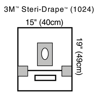 SOLVENTUM STERI-DRAPE OPHTHALMIC SURGICAL DRAPESSmall Drape with Adhesive Aperture & Pouch, 15" x 19", 2 Adhesive Patches, Fluid Collection Pouch, 10/bx, 4 bx/cs | Quantity - 1x CS
