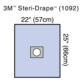 SOLVENTUM STERI-DRAPE MINOR PROCEDURE DRAPE - Small Drape, Adhesive Aperture, 22" x 25", 3M Biocade Fabric, 25/bx, 4 bx/cs | Quantity - 1x CS
