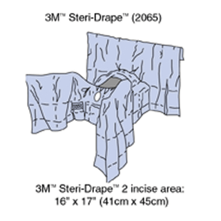 SOLVENTUM GENERAL SURGERY DRAPESSteri-Drape Abdominal Perineal Drape with Incise Film, 160", Lithotomy Position, Absorbent Impervious Material, Incise Aperture, Perineal/ Vaginal Aperture, 4 Tube Organizer, 8/bx, 2 bx/cs | Quantity - 1x CS