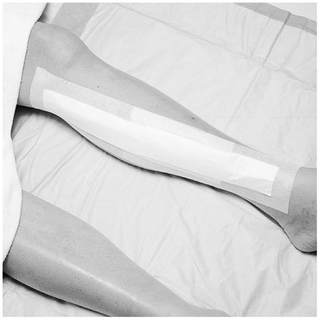 SOLVENTUM MEDIPORE +PAD SOFT CLOTH ADHESIVE WOUND DRESSING - Wound Dressing, 3" x 4", Pad Size 1" x 2 3/8", 25/bx, 4 bx/cs (Continental US+HI Only) | Quantity - 1x CS